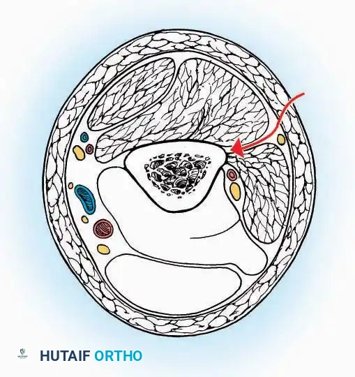 Hutaifortho's Orthopaedic Diagram
