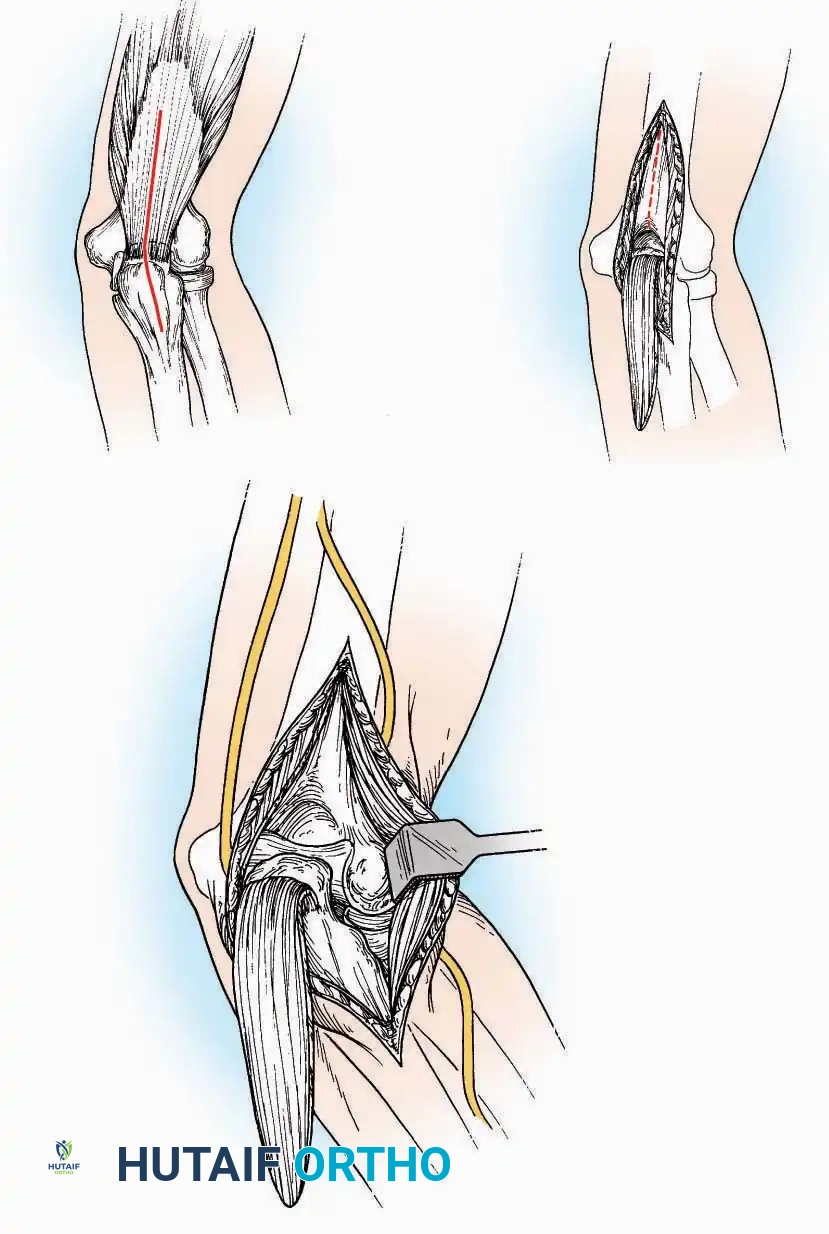 Hutaifortho's Orthopaedic Diagram