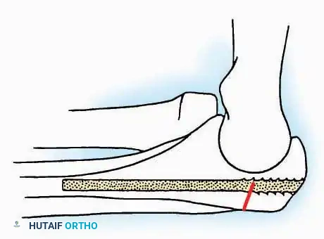 Hutaifortho's Orthopaedic Diagram