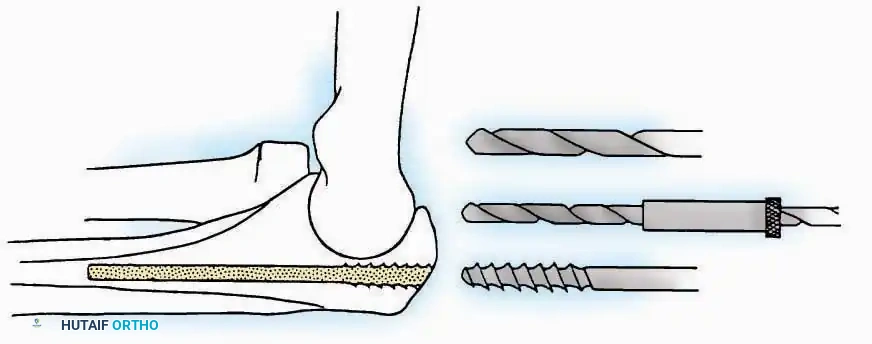 Hutaifortho's Orthopaedic Diagram