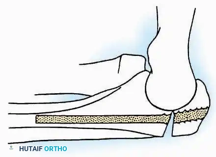 Hutaifortho's Orthopaedic Diagram