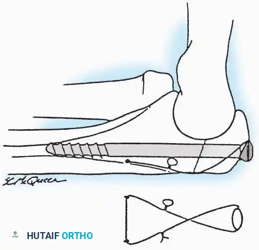 Hutaifortho's Orthopaedic Diagram