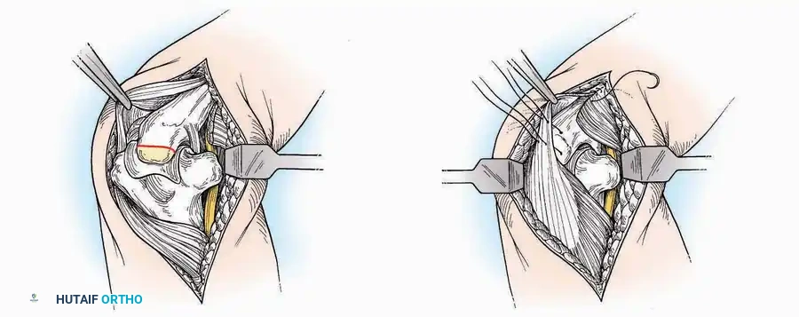 Hutaifortho's Orthopaedic Diagram