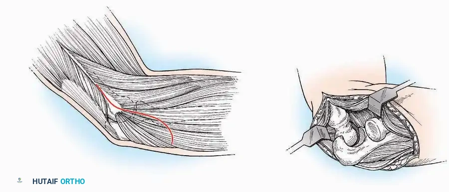 Hutaifortho's Orthopaedic Diagram