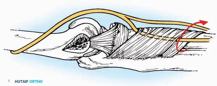 Hutaifortho's Orthopaedic Diagram
