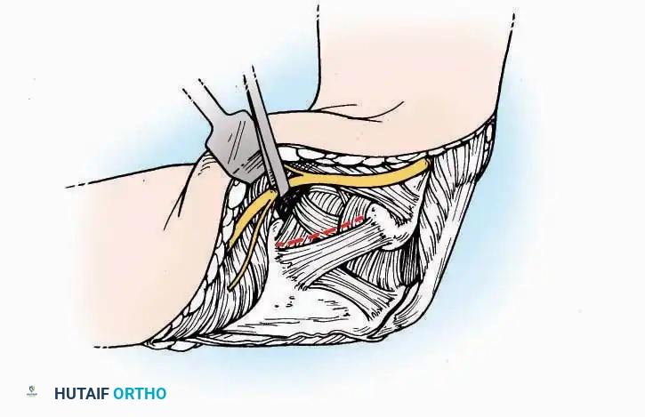 Hutaifortho's Orthopaedic Diagram