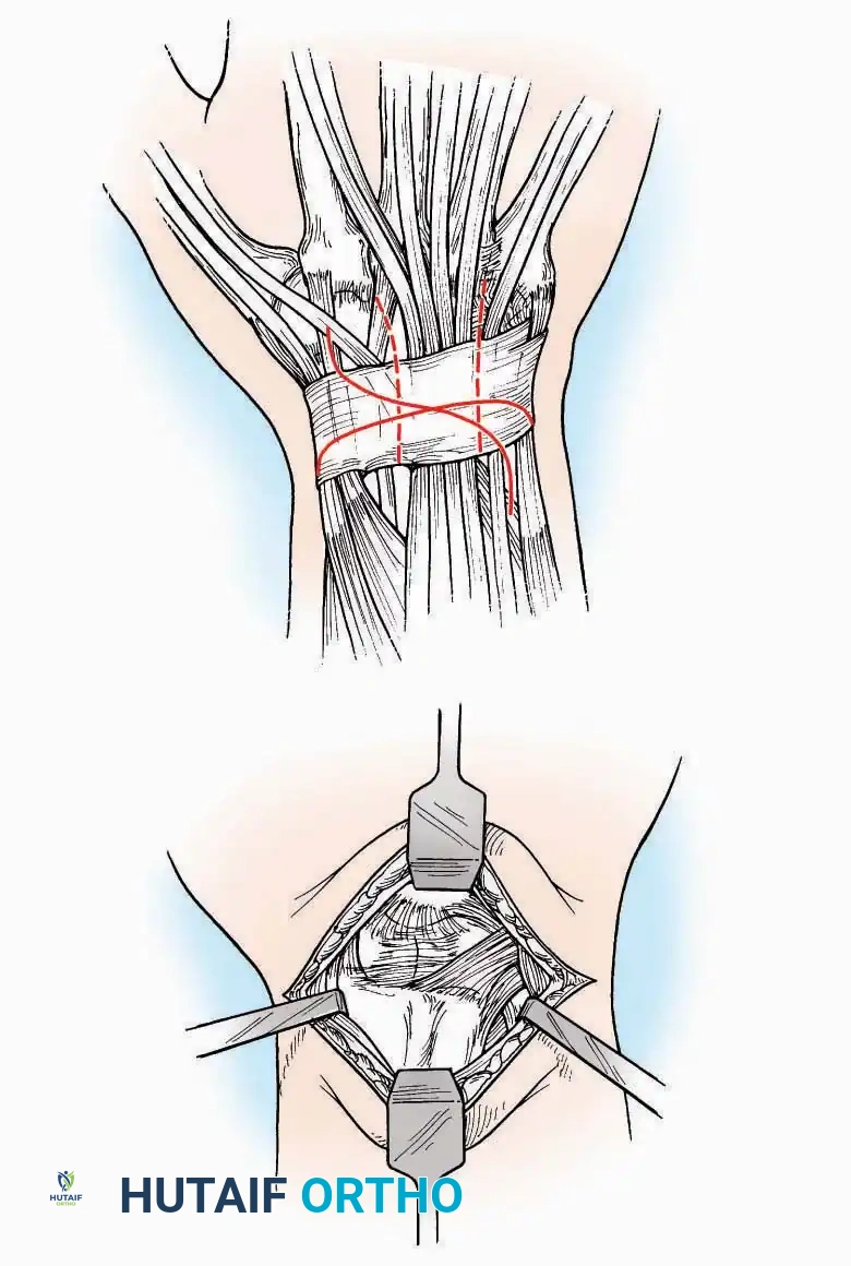 Hutaifortho's Orthopaedic Diagram