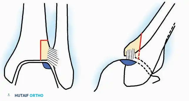 Hutaifortho's Orthopaedic Diagram