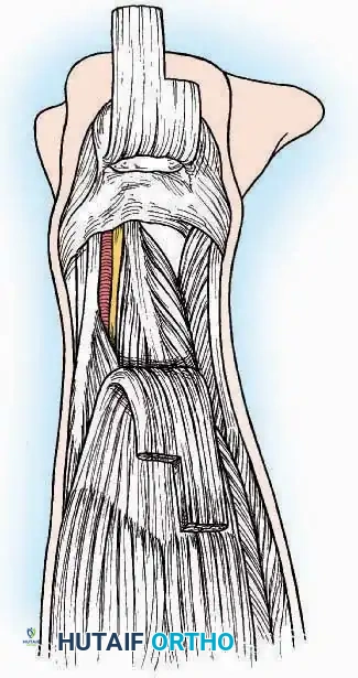 Hutaifortho's Orthopaedic Diagram