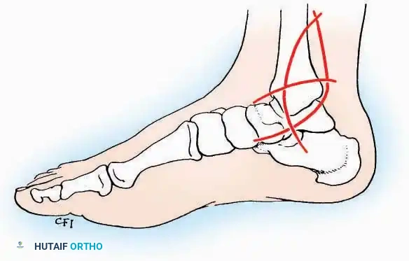 Hutaifortho's Orthopaedic Diagram