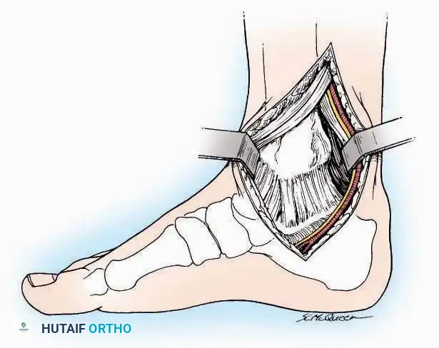 Hutaifortho's Orthopaedic Diagram