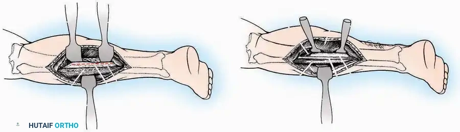 Hutaifortho's Orthopaedic Diagram