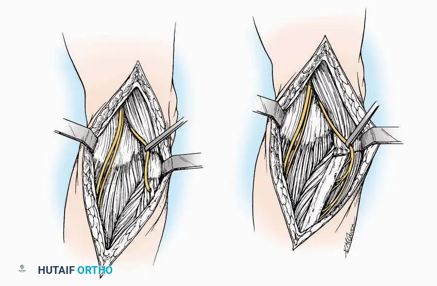 Hutaifortho's Orthopaedic Diagram