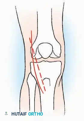 Hutaifortho's Orthopaedic Diagram