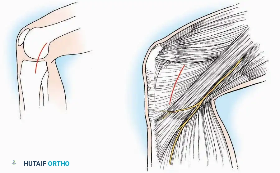 Hutaifortho's Orthopaedic Diagram