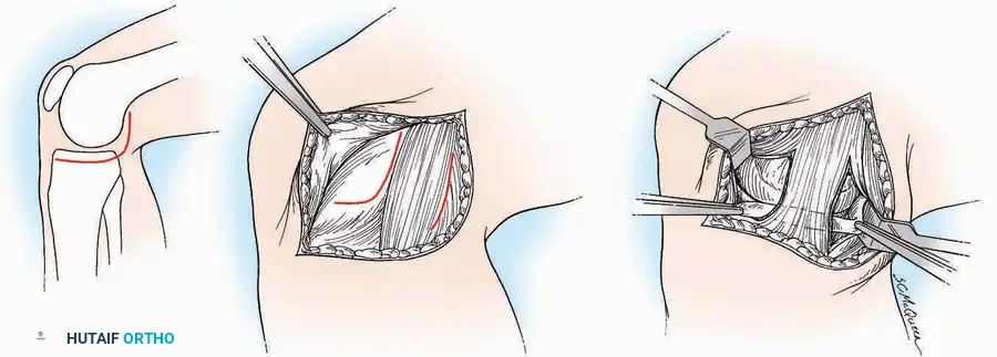 Hutaifortho's Orthopaedic Diagram