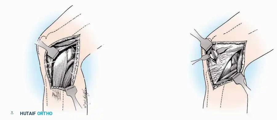 Hutaifortho's Orthopaedic Diagram