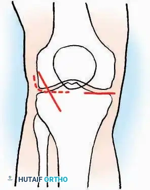 Hutaifortho's Orthopaedic Diagram