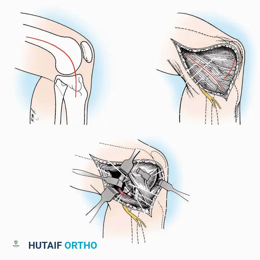 Hutaifortho's Orthopaedic Diagram