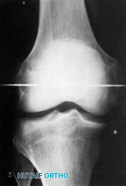Hutaifortho's Orthopaedic Diagram