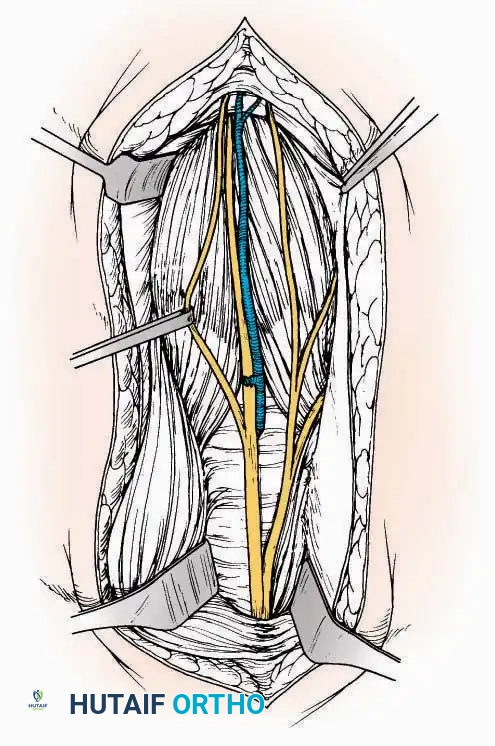 Hutaifortho's Orthopaedic Diagram