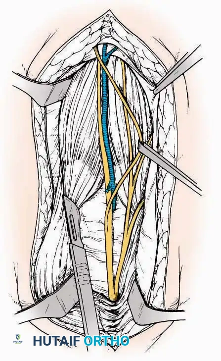 Hutaifortho's Orthopaedic Diagram