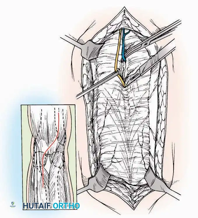 Hutaifortho's Orthopaedic Diagram