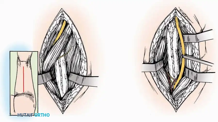 Hutaifortho's Orthopaedic Diagram