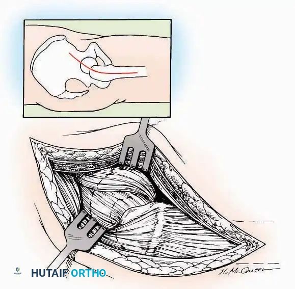 Hutaifortho's Orthopaedic Diagram