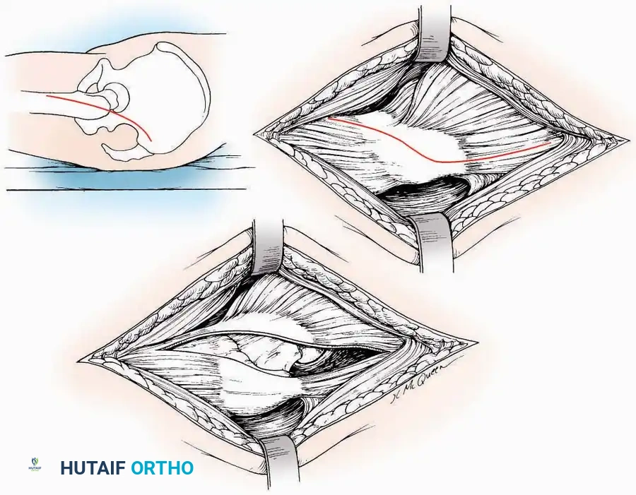 Hutaifortho's Orthopaedic Diagram