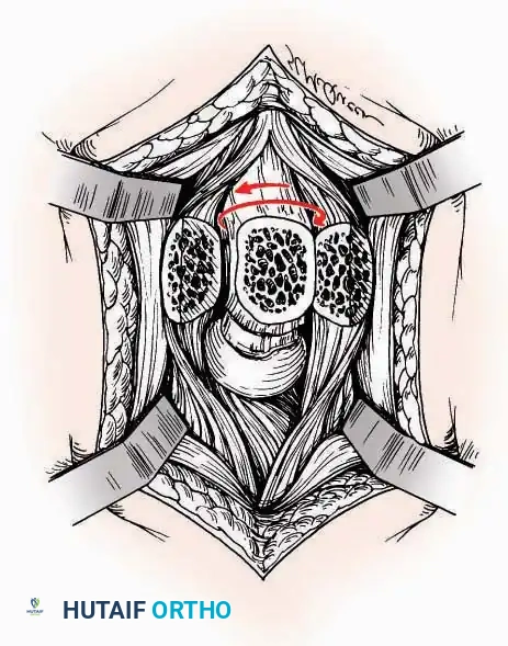 Hutaifortho's Orthopaedic Diagram