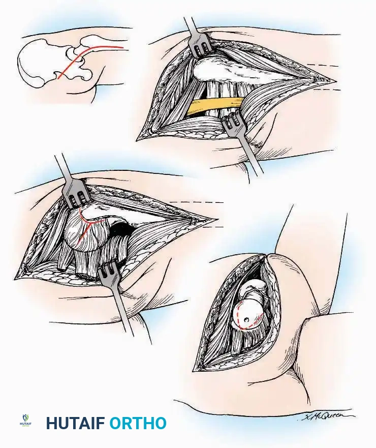 Hutaifortho's Orthopaedic Diagram
