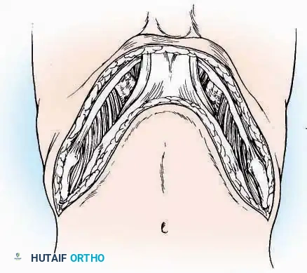 Hutaifortho's Orthopaedic Diagram