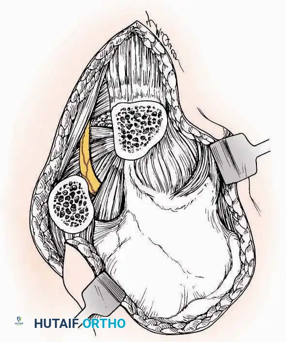Hutaifortho's Orthopaedic Diagram