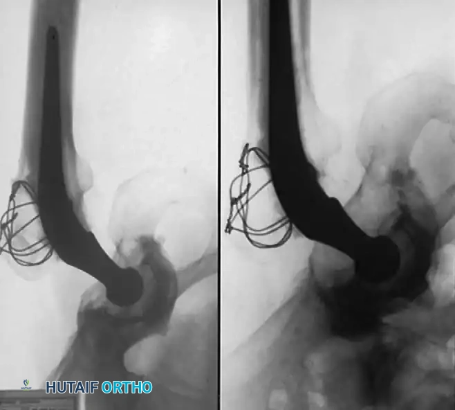 Hutaifortho's Orthopaedic Diagram