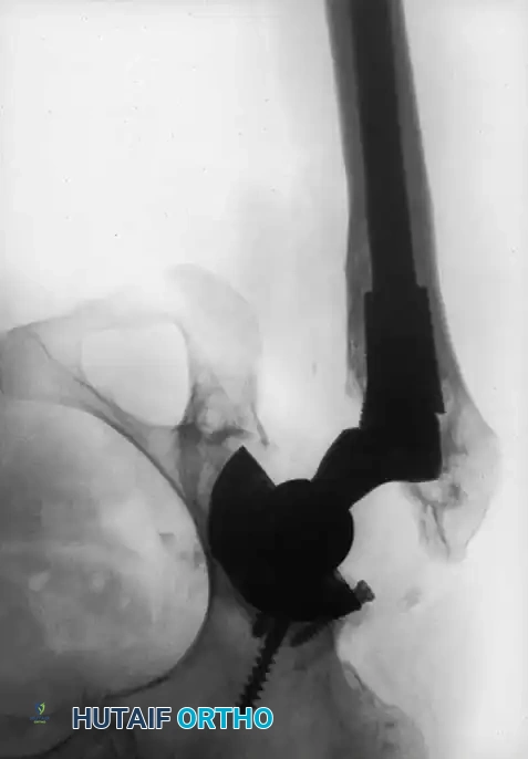 Hutaifortho's Orthopaedic Diagram