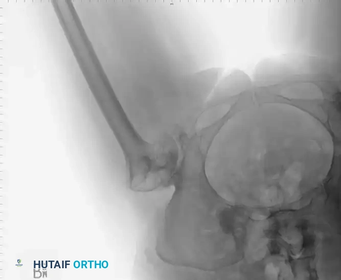 Hutaifortho's Orthopaedic Diagram