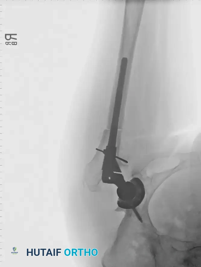 Hutaifortho's Orthopaedic Diagram