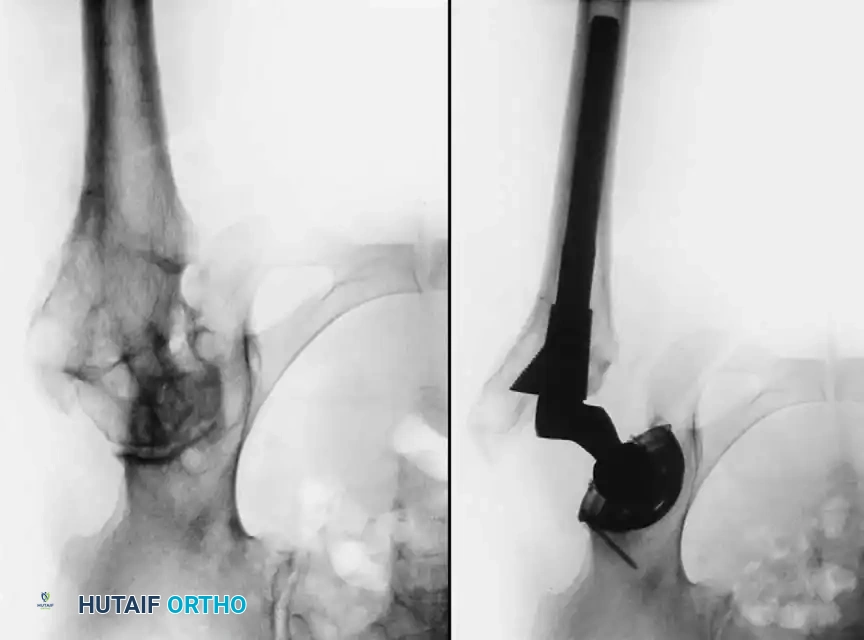 Hutaifortho's Orthopaedic Diagram