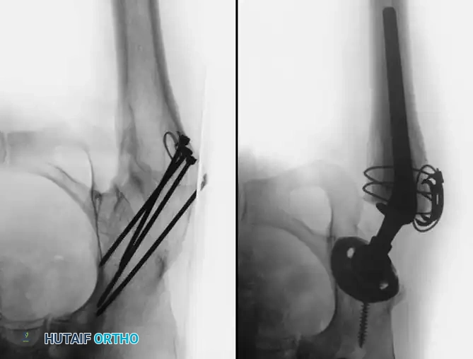 Hutaifortho's Orthopaedic Diagram