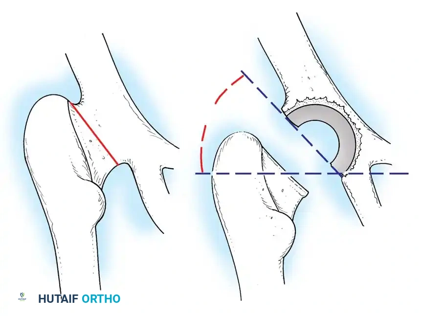 Hutaifortho's Orthopaedic Diagram