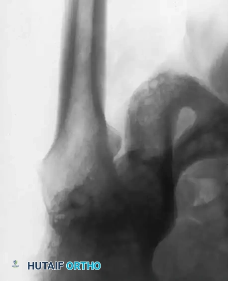 Hutaifortho's Orthopaedic Diagram