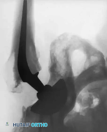 Hutaifortho's Orthopaedic Diagram