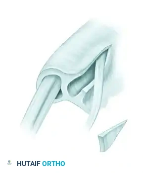 Superficial branch radial nerve