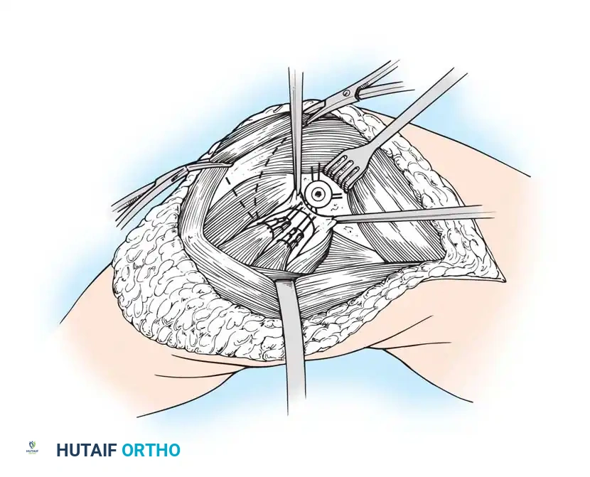 Hutaifortho's Orthopaedic Diagram