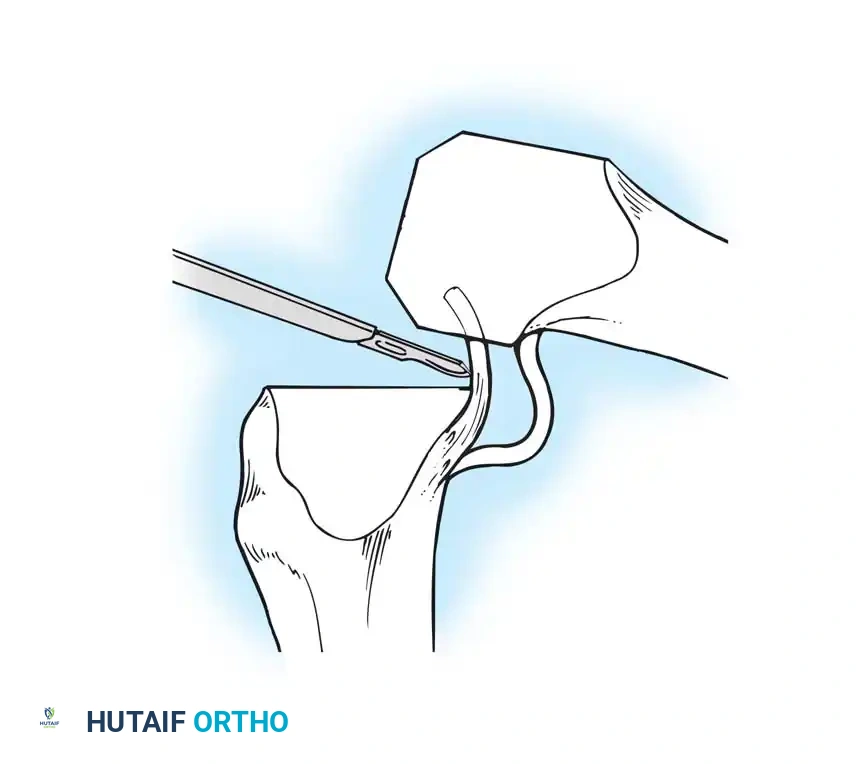 Hutaifortho's Orthopaedic Diagram