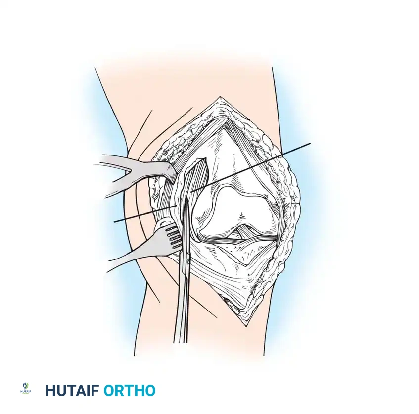 Hutaifortho's Orthopaedic Diagram