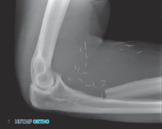Hutaifortho's Orthopaedic Diagram