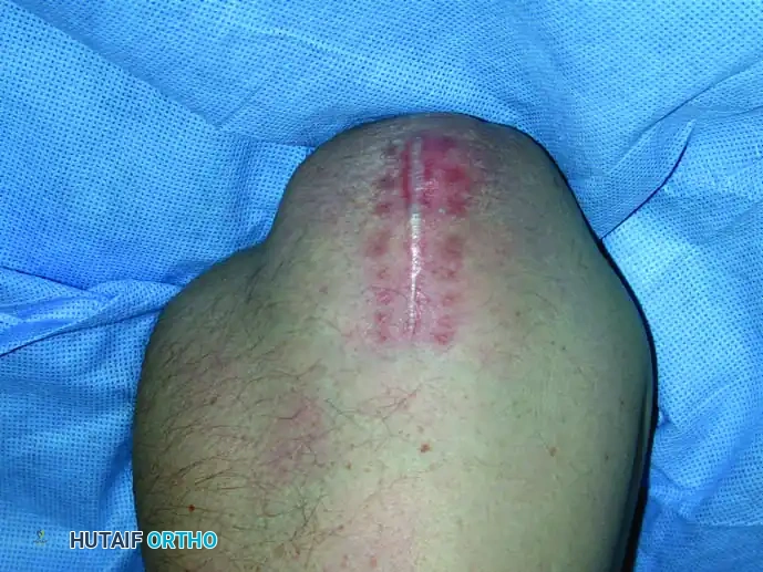 Hutaifortho's Orthopaedic Diagram