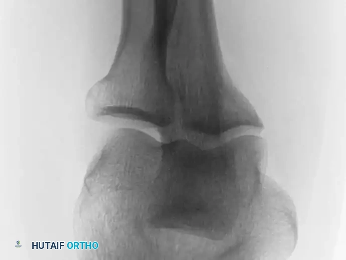 Hutaifortho's Orthopaedic Diagram